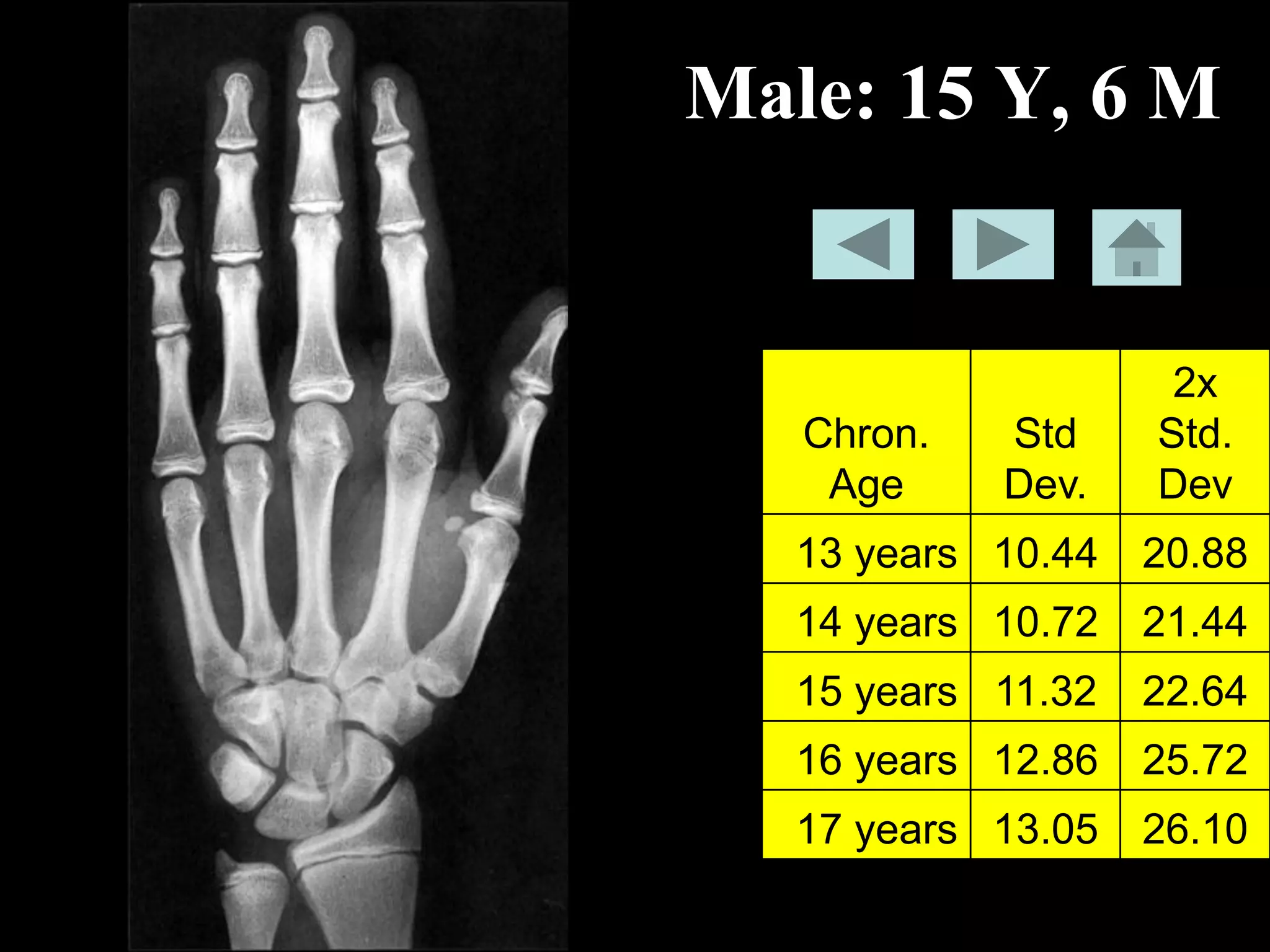 Bone-age-book.pdf