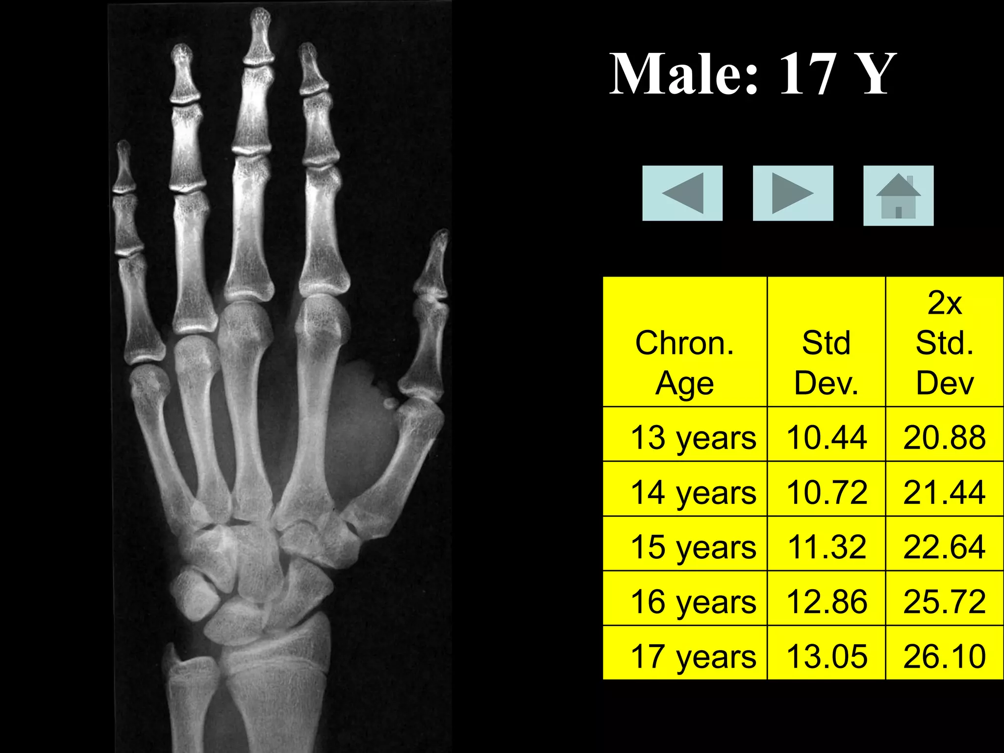 Bone-age-book.pdf