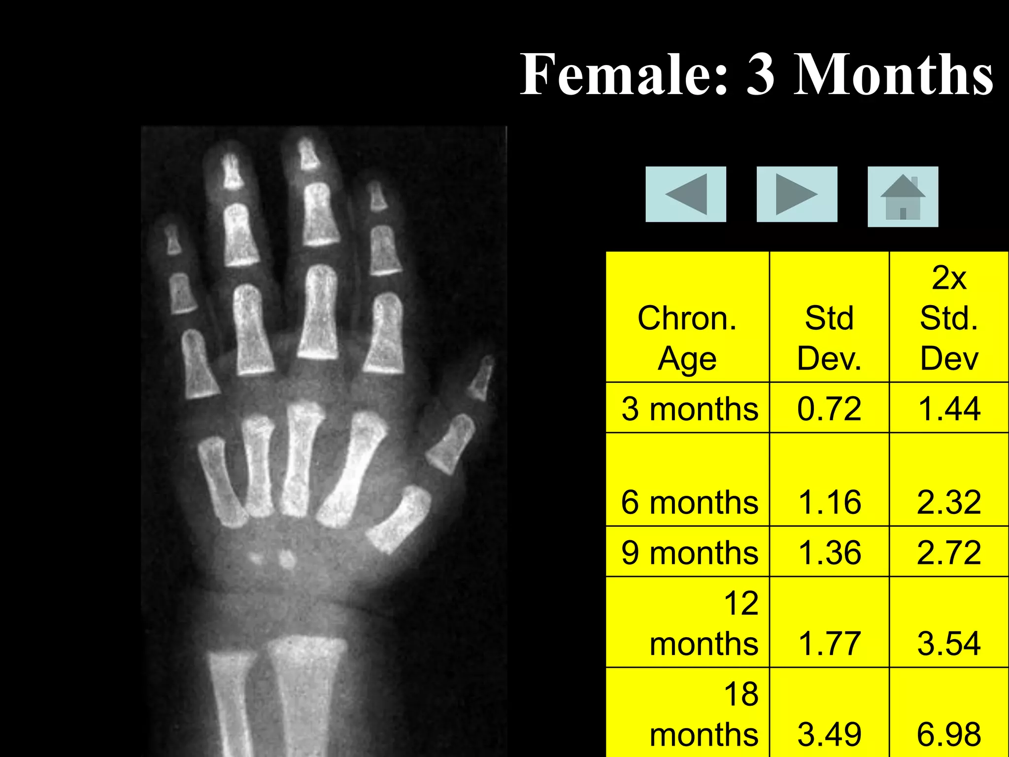 Bone-age-book.pdf