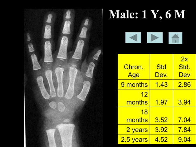 Bone-age-book.pdf