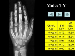 Bone-age-book.pdf