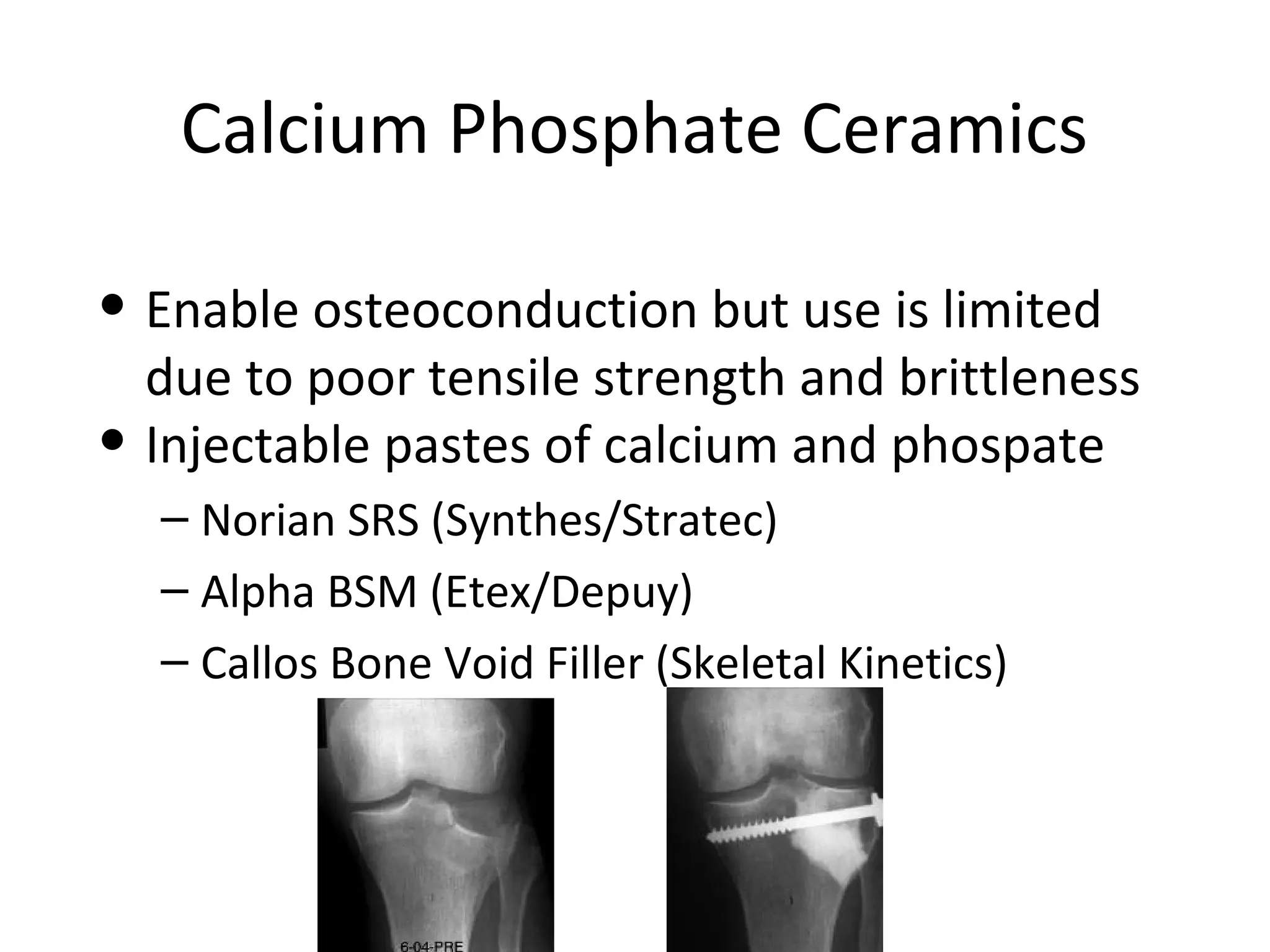 Calcium Phosphate Ceramics 
• Enable osteoconduction but use is limited 
due to poor tensile strength and brittleness 
• Injectable pastes of calcium and phospate 
– Norian SRS (Synthes/Stratec) 
– Alpha BSM (Etex/Depuy) 
– Callos Bone Void Filler (Skeletal Kinetics) 
 