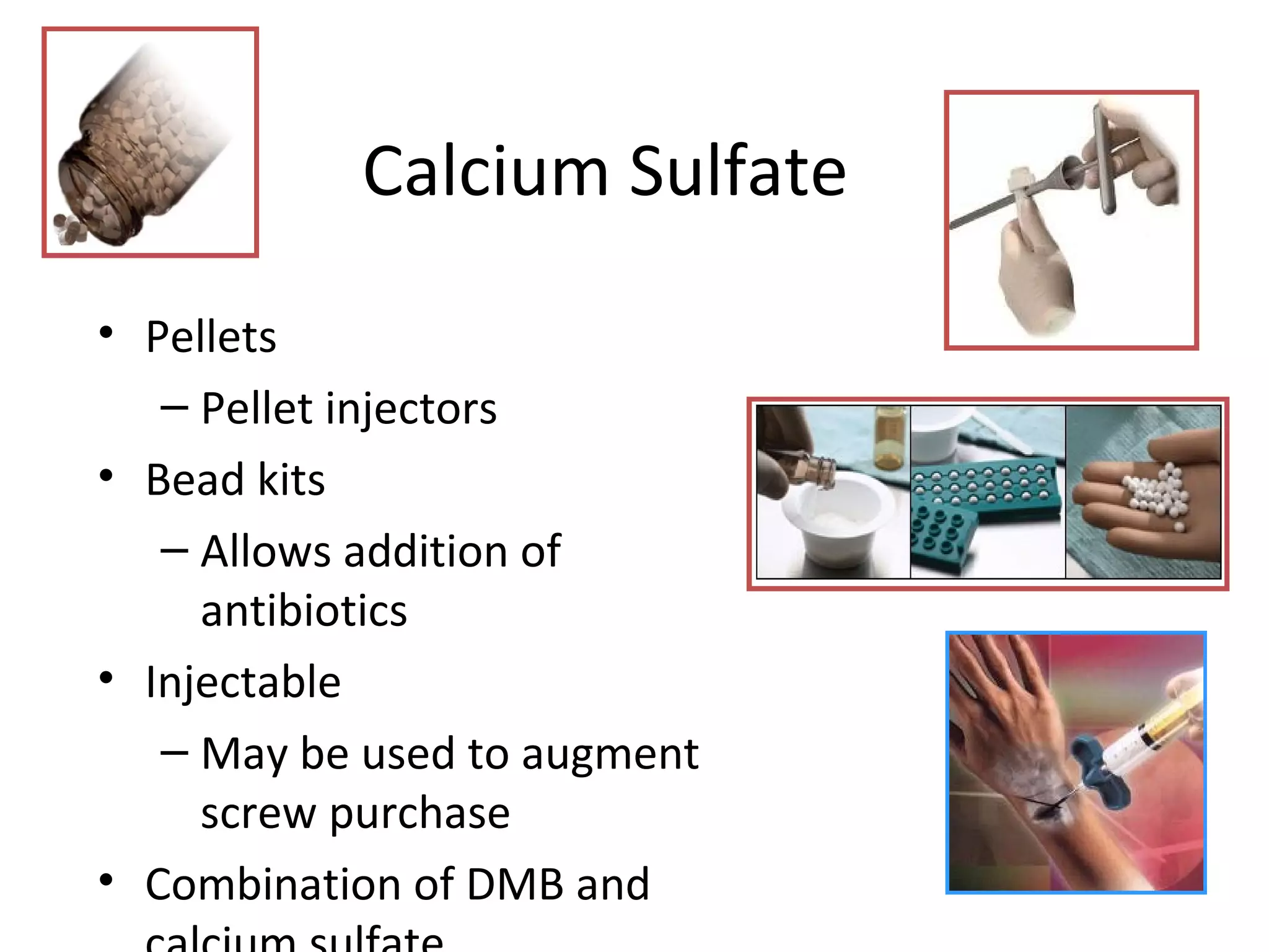Calcium Sulfate 
• Pellets 
– Pellet injectors 
• Bead kits 
– Allows addition of 
antibiotics 
• Injectable 
– May be used to augment 
screw purchase 
• Combination of DMB and 
calcium sulfate 
 