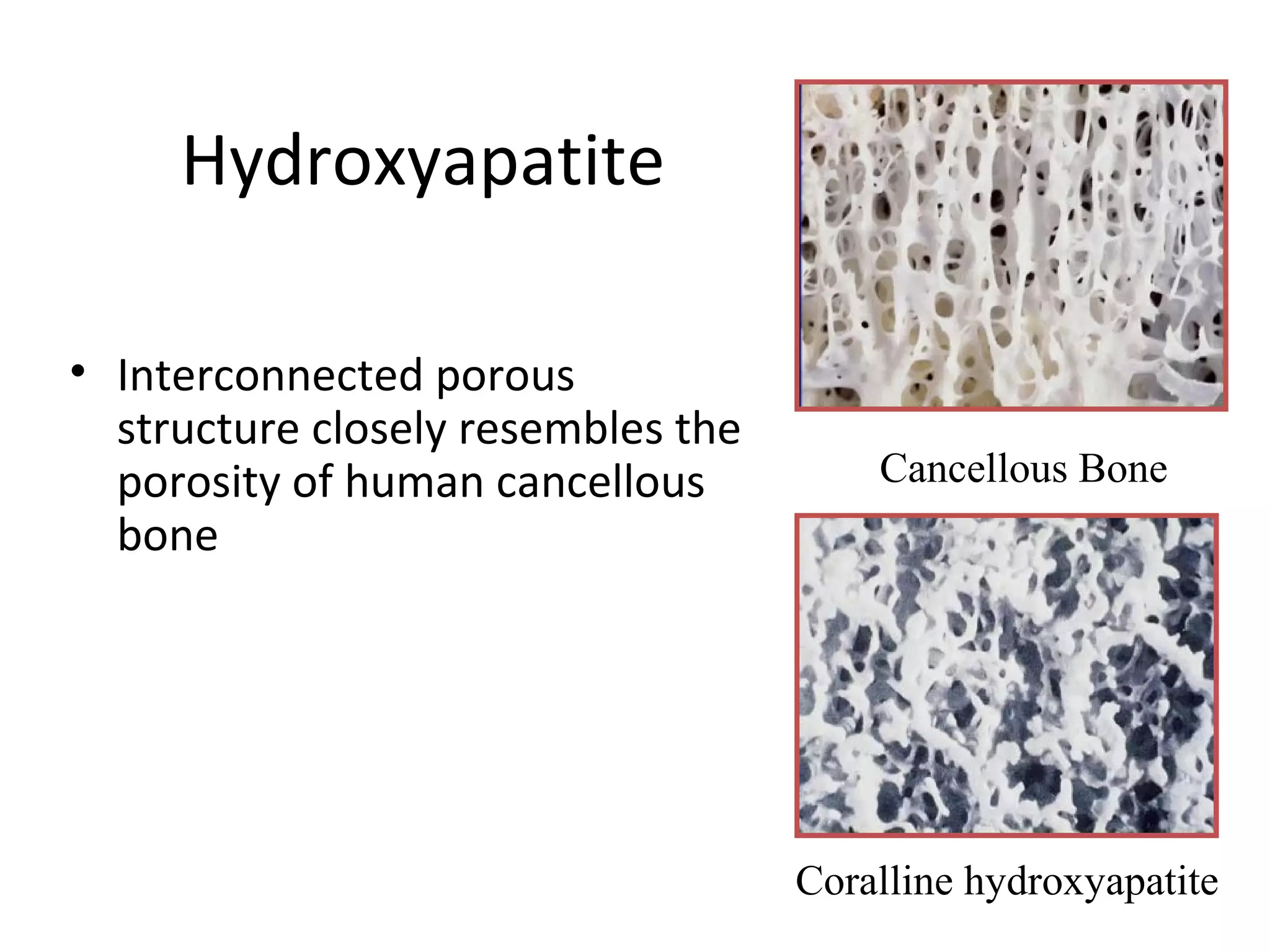 Hydroxyapatite 
• Interconnected porous 
structure closely resembles the 
porosity of human cancellous 
bone 
Cancellous Bone 
Coralline hydroxyapatite 
 