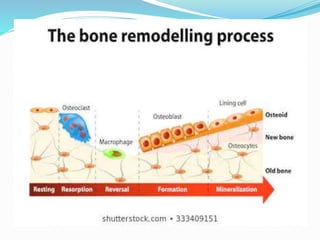 Bone   histology