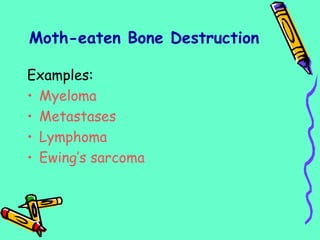 Examples:
• Myeloma
• Metastases
• Lymphoma
• Ewing’s sarcoma
Moth-eaten Bone Destruction
 