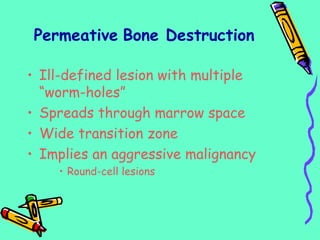 Permeative Bone Destruction
• Ill-defined lesion with multiple
“worm-holes”
• Spreads through marrow space
• Wide transition zone
• Implies an aggressive malignancy
• Round-cell lesions
 