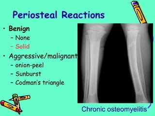 Periosteal Reactions
• Benign
– None
– Solid
• Aggressive/malignant
– onion-peel
– Sunburst
– Codman’s triangle
Chronic osteomyelitis
 