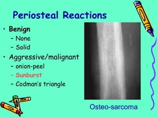 Periosteal Reactions
• Benign
– None
– Solid
• Aggressive/malignant
– onion-peel
– Sunburst
– Codman’s triangle
Osteo-sarcoma
 