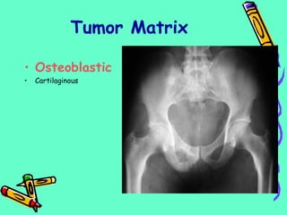 Tumor Matrix
• Osteoblastic
• Cartilaginous
 