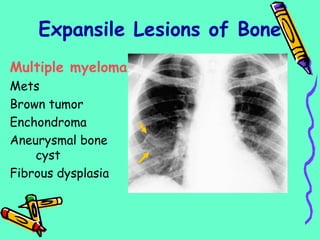 Expansile Lesions of Bone
Multiple myeloma
Mets
Brown tumor
Enchondroma
Aneurysmal bone
cyst
Fibrous dysplasia
 