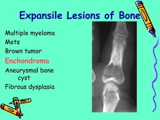 Multiple myeloma
Mets
Brown tumor
Enchondroma
Aneurysmal bone
cyst
Fibrous dysplasia
Expansile Lesions of Bone
 