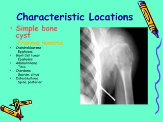 Characteristic Locations
• Simple bone
cyst
Proximal humerus
• Chondroblastoma
Epiphyses
• Giant Cell tumor
Epiphyses
• Adamantinoma
Tibia
• Chordoma
Sacrum, clivus
• Osteoblastoma
Spine, posterior
 