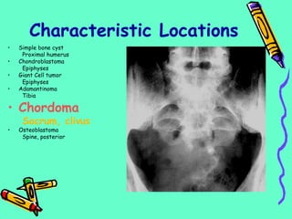• Simple bone cyst
Proximal humerus
• Chondroblastoma
Epiphyses
• Giant Cell tumor
Epiphyses
• Adamantinoma
Tibia
• Chordoma
Sacrum, clivus
• Osteoblastoma
Spine, posterior
Characteristic Locations
 