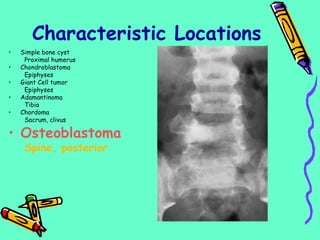 • Simple bone cyst
Proximal humerus
• Chondroblastoma
Epiphyses
• Giant Cell tumor
Epiphyses
• Adamantinoma
Tibia
• Chordoma
Sacrum, clivus
• Osteoblastoma
Spine, posterior
Characteristic Locations
 