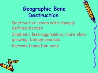 Geographic Bone
Destruction
• Destructive lesion with sharply
defined border
• Implies a less-aggressive, more slow-
growing, benign process
• Narrow transition zone
 