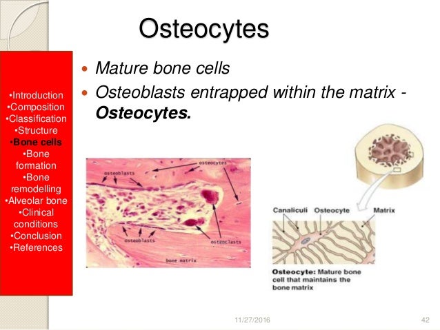 Bone Bone