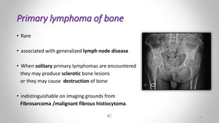 Primary lymphoma of bone
• Rare
• associated with generalized lymph node disease
• When solitary primary lymphomas are encountered
they may produce sclerotic bone lesions
or they may cause destruction of bone
• indistinguishable on imaging grounds from
Fibrosarcoma /malignant fibrous histiocytoma.
12
 