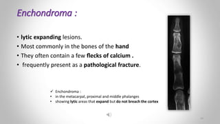 Enchondroma :
• lytic expanding lesions.
• Most commonly in the bones of the hand
• They often contain a few ﬂecks of calcium .
• frequently present as a pathological fracture.
 Enchondroma :
• in the metacarpal, proximal and middle phalanges
• showing lytic areas that expand but do not breach the cortex
14
 
