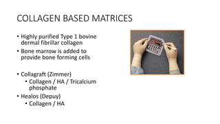 BONE GRAFTING AND SUBSTITUTES | PPTX