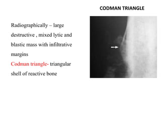 Codmann Triangle bone tumor | PPTX