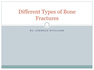 Different Types of Bone
       Fractures

    BY: JERROLD WILLIAMS
 