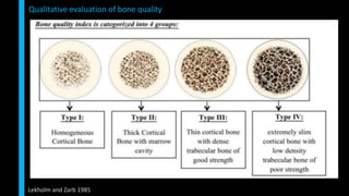 Bone basics for dentists | PPTX