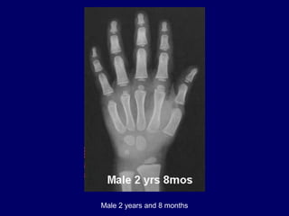 Male 2 years and 8 months
 