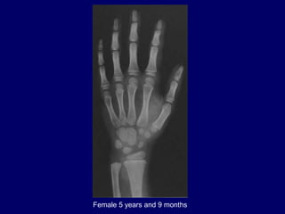 Female 5 years and 9 months
 