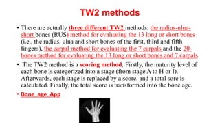 TW2 methods
• There are actually three different TW2 methods: the radius-ulna-
short bones (RUS) method for evaluating the 13 long or short bones
(i.e., the radius, ulna and short bones of the first, third and fifth
fingers), the carpal method for evaluating the 7 carpals and the 20-
bones method for evaluating the 13 long or short bones and 7 carpals.
• The TW2 method is a scoring method. Firstly, the maturity level of
each bone is categorized into a stage (from stage A to H or I).
Afterwards, each stage is replaced by a score, and a total sore is
calculated. Finally, the total score is transformed into the bone age.
• Bone age App
 