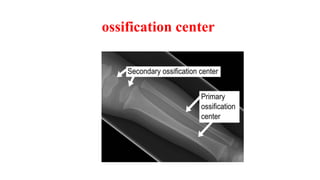 ossification center
 