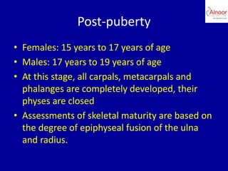 Bone age assessment | PPTX
