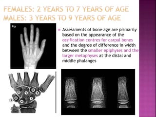 Bone Age Classification Method Bone age assessment dr ankita | PPTX
