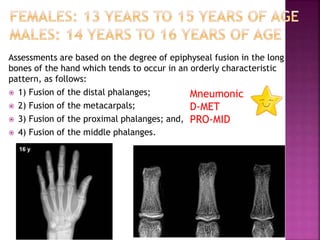 Bone age assessment dr ankita | PPTX