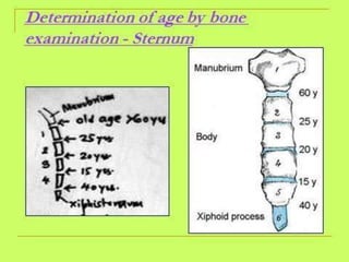 Bone Age Classification Method Bone age assessment dr ankita | PPTX