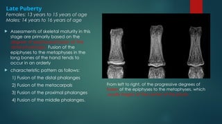 Bone age determination by assessment of skeletal maturity.pptx