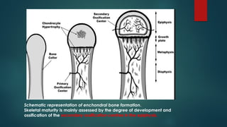 Bone age determination by assessment of skeletal maturity.pptx