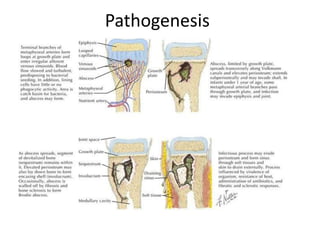 Pathogenesis
 