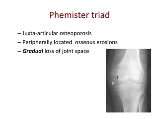 Phemister triad
– Juxta-articular osteoporosis
– Peripherally located osseous erosions
– Gradual loss of joint space
 