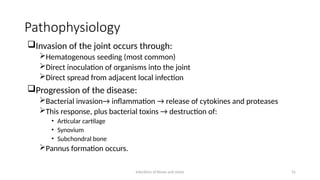 Comprehensive Overview of Bone and Joint Infections: Osteomyelitis and ...
