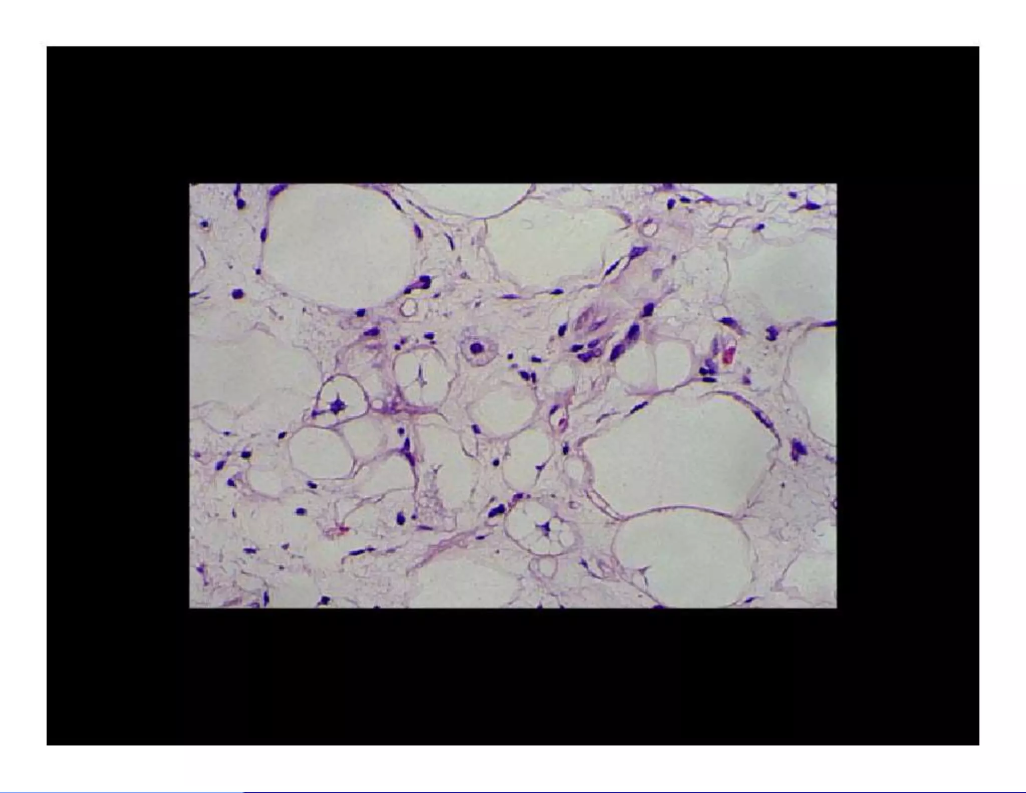 Bone and soft tissue pathology | PPTX