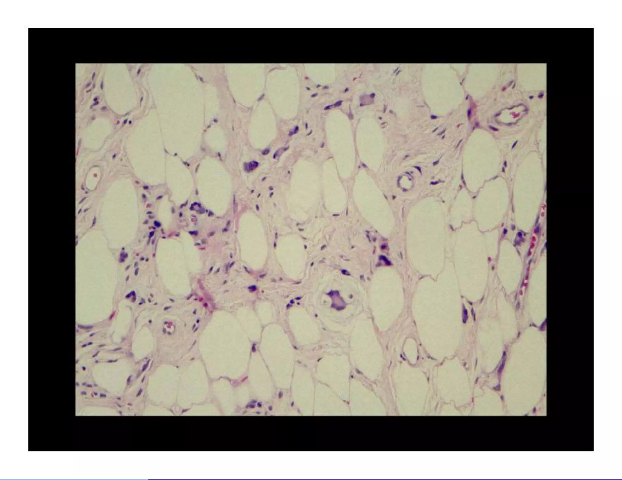 Bone and soft tissue pathology | PPTX