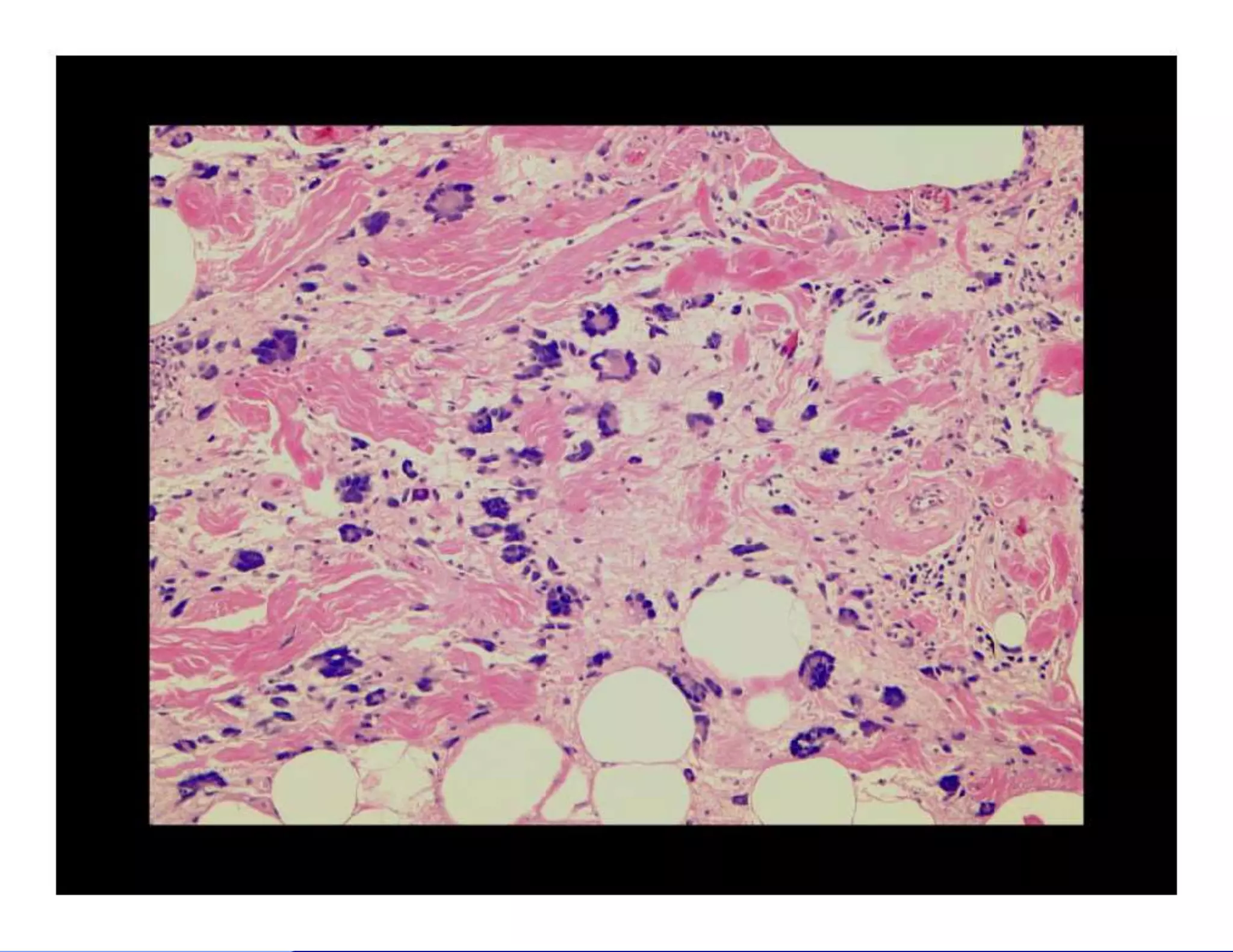 Bone and soft tissue pathology | PPTX