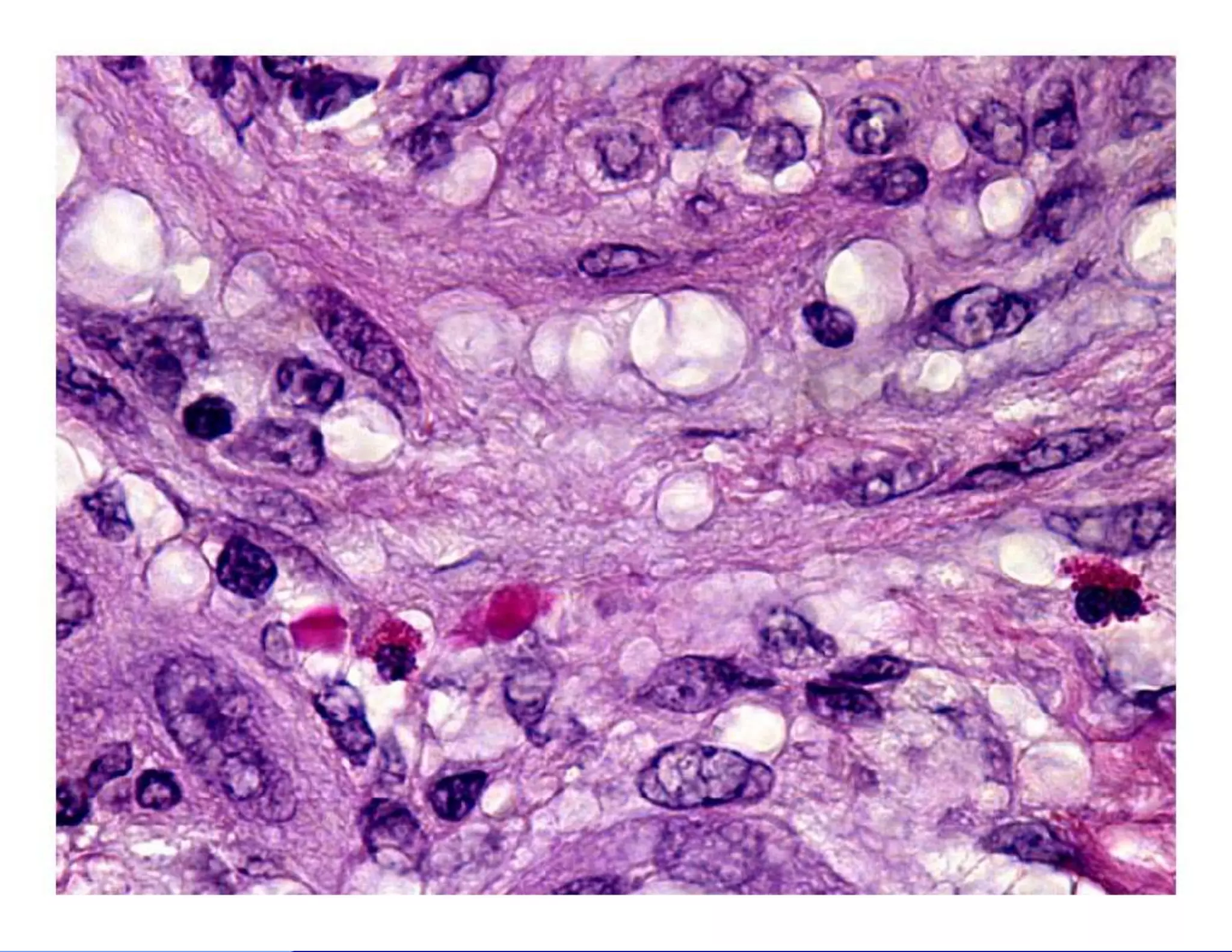 Bone and soft tissue pathology | PPTX