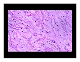Bone and soft tissue pathology | PPTX