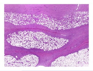 Bone and soft tissue pathology | PPTX