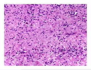 Bone and soft tissue pathology | PPTX