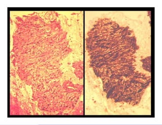 Bone and soft tissue pathology | PPTX