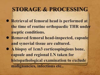 Bone bank presentation