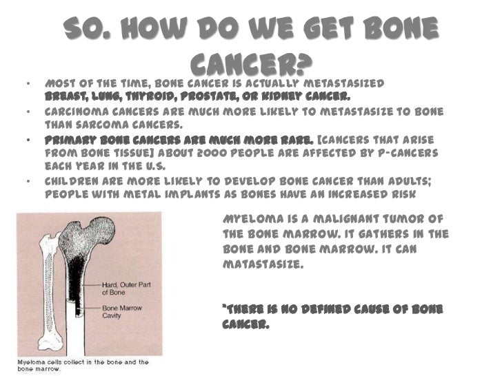 Image result for CANCEROUS BONE PICTURES IMAGES